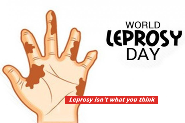 World leprosy Day कुष्ठ रोग दिवस