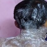 युवती ने युवक के चेहरे पर तेजाब डाला, शादी से इनकार करने पर भड़की