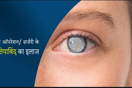 बिना ऑपरेशन मोतियाबिंद का इलाज - Cataract Treatment without Surgery in India