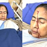 ममता बनर्जी के माथे-नाक पर 4 टांके लगे, डॉक्टर बोले- उन्हें किसी ने धक्का दिया था
