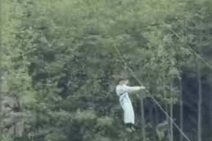 A 10-year-old girl fell from a height of 30 feet