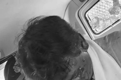BJP MP attacked in Bengal's Jalpaiguri, head fractured